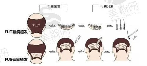 大连京城植发怎么样