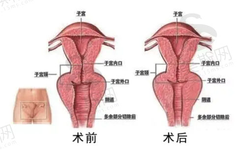 青岛私密整形医院哪家好