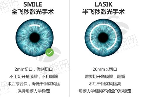 鄭州哪家近視眼手術(shù)做得好