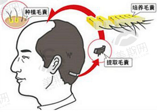 武汉仁爱植发怎么样