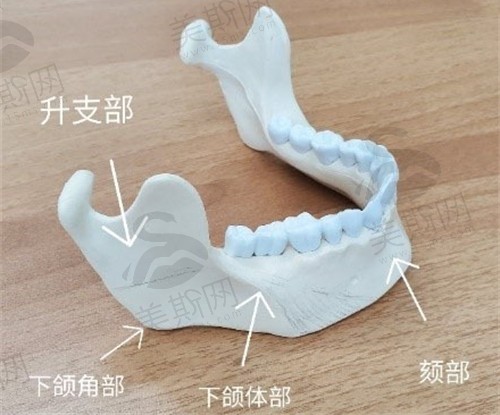 重庆松山医院朱乐林医生做的磨骨手术技术高超