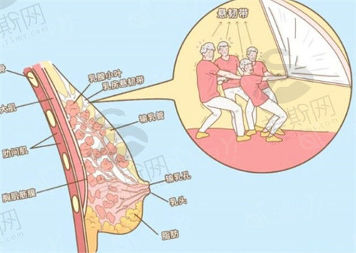 胸部悬吊提升手术对乳腺有伤害吗