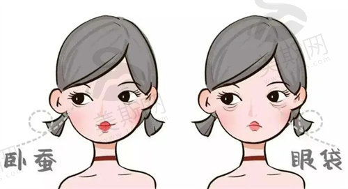 溶脂去眼袋的优缺点