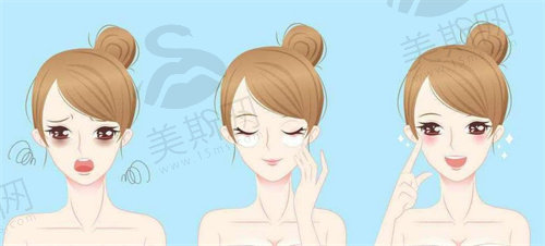 眼袋怎么去除更有效