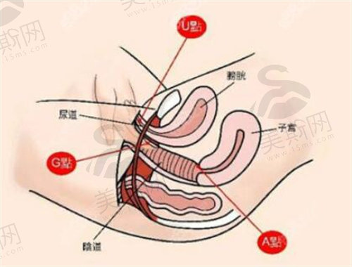 那种紧缩术伤害小？