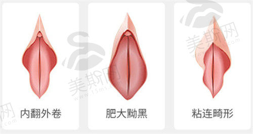下边有一块肉能拉很长怎么办？
