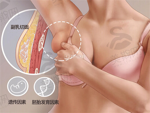 吸脂去副乳什么时候能看到疗效