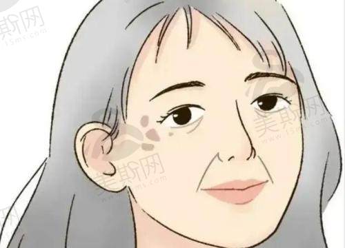苹果肌下垂提升的好方法