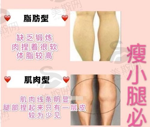 腰腹环吸和大腿吸脂手术前准备