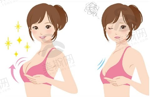 人工韧带乳房提升术前后注意事项