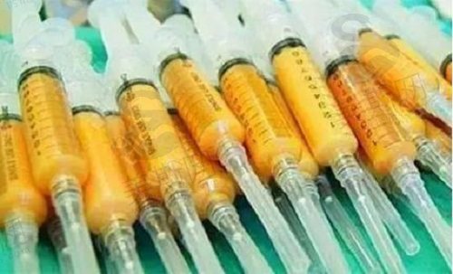 颈阔肌松弛导致双下巴怎么办