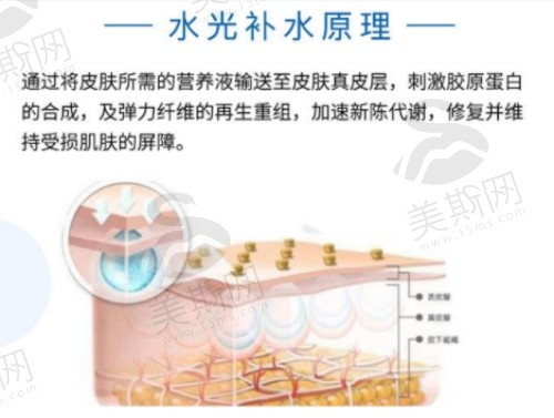 润致水光和嗨体水光哪个好