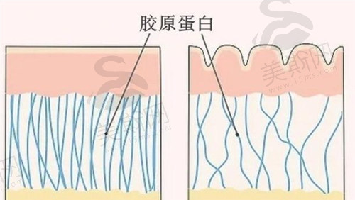 什么是1型胶原蛋白？