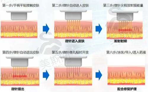 深圳春天阳光整形医院7月钜惠套卡项目