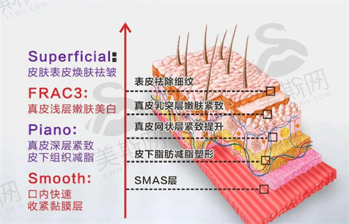 芮艾瑅少女枪术后注意事项