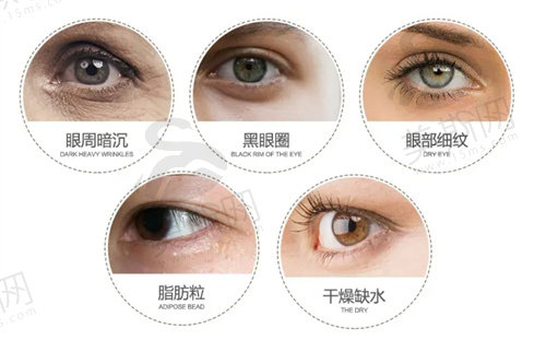 薇旖美三型胶原蛋白打眼周有用吗
