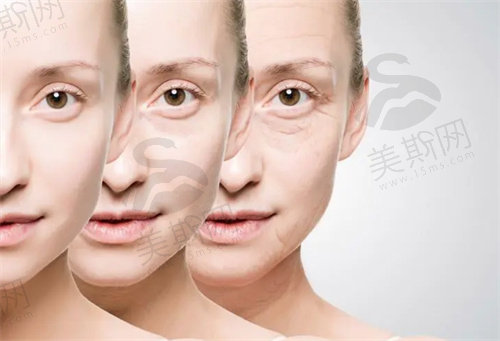 薇旖美三型胶原蛋白多少钱一支