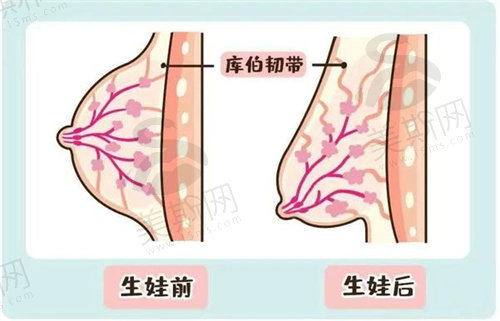 上海时光医疗美容徐怀河医生巨乳缩小技术成熟