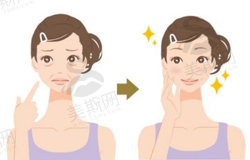 面部提升三件套是什么