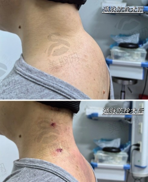 惠州黄学峰富贵包医疗美容（原诗璐）