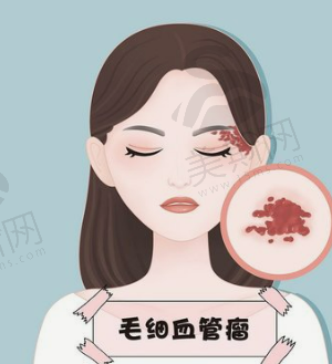 北京丰台医院可以做双眼皮吗？多少钱？有李辉医生做的案例分享！