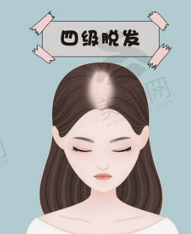 北京大学第一医院可以做双眼皮吗？多少钱？内有案例、医生分享！