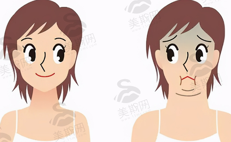 祁阳县人民医院可以做双眼皮吗？多少钱？有术后双眼皮的案例分享！