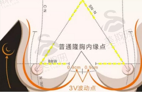 爱美汇医疗美容假体隆胸靠谱吗？详细医院简介+ 医生信息