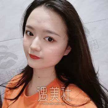 温州上雅医学美容门诊部：专业概况+非常新双眼皮案例分享