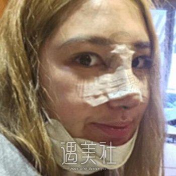 美中宜和北三环美容科：综合评价及隆鼻修复案例分享