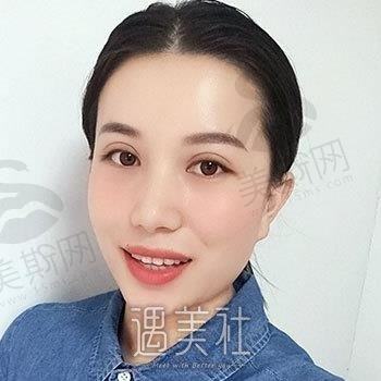 杭州伊瑞医美双眼皮整形案例及价格更新，了解正规性及口碑如何