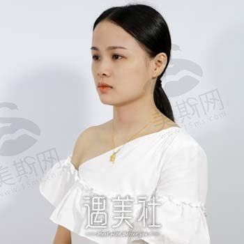 永城爱尔美整形医院：医生团队实力揭秘，非常新隆鼻案例分享