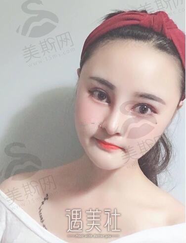 郑州和妍医美怎么样？正规吗？医生团队介绍+双眼皮案例