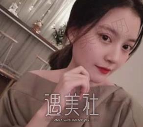 上海柔伊医疗美容医院怎么样？特色项目介绍+埋线双眼皮案例