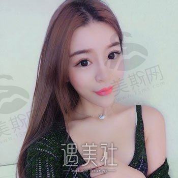 广州安美医疗整形美容怎么样？去眼袋案例公布