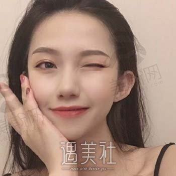 美莱孙明磊做鼻子怎么样？医生简介+隆鼻案例分享