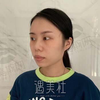 长沙瑞亚时光女神整形美容医院怎么样？口碑技术点评+价格表