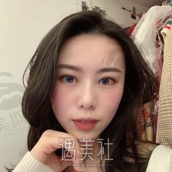 长沙瑞亚时光女神整形美容医院怎么样？口碑技术点评+价格表