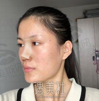 广州美漾医疗美容怎么样？地址在哪？概况介绍+隆鼻案例