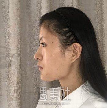 广州美漾医疗美容怎么样？地址在哪？概况介绍+隆鼻案例