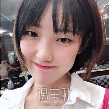 长安港湾医院有美容吗？美容科简介+双眼皮整形案例分享