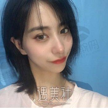 成都爱美蒂亚医疗美容机构正规吗？技术怎么样？双眼皮案例