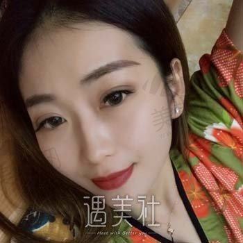 徐俊彪医美鼻王技术怎么样？美鼻整形案例对比图鉴赏