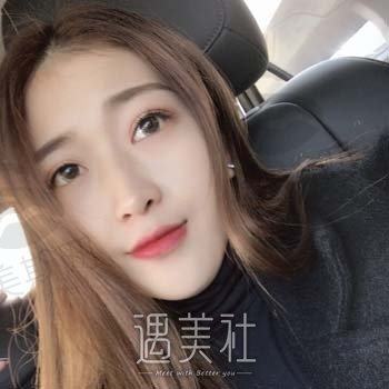 徐俊彪医美鼻王技术怎么样？美鼻整形案例对比图鉴赏