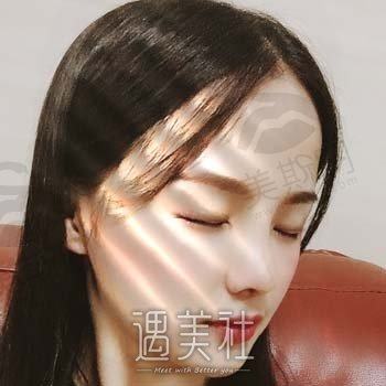 杭州美悦医疗美容正规吗？技术怎么样？隆鼻案例鉴赏