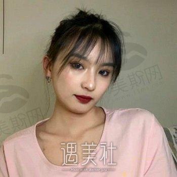 广州都美医疗美容门诊部怎么样？电话|地址|双眼皮案例