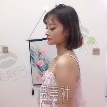 西安伊美尔医疗美容医院怎么样？坐诊医生介绍+隆胸案例