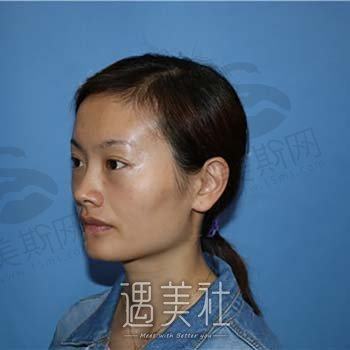 上海本真唯美医疗美容医院怎么样？正规吗？医生团队介绍