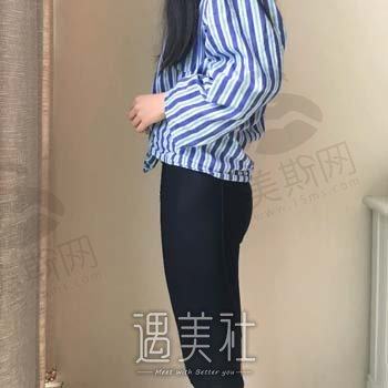 成都抽脂医生刘俊怎么样？医生个人信息+大腿抽脂案例