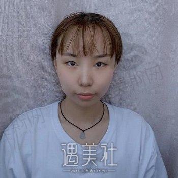 上海悦目佳容医疗美容门诊部怎么样？正规吗？双眼皮案例